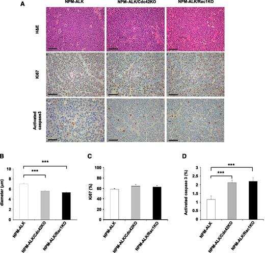 Figure 2. Apoptosis induced by Cdc42 or Rac1 deletion impairs NPM-ALK lymphoma development in vivo. (A) Representative histology of lymphoma arising in NPM-ALK, NPM-ALK;CD4Cre;Cdc42fl/fl (NPM-ALK/Cdc42KO), or NPM-ALK;CD4Cre;Rac1fl/fl (NPM-ALK/Rac1KO) mice (top). Immunostainings for Ki-67 (middle) and activated caspase-3 (bottom) in tumors of the indicated genotypes are shown. Scale bar, 50 μm. (B) Histograms represent the average diameter quantified by counting at least 100 cells for each genotype. Error bars indicated SEM. ***P < .001. (C) Quantification of the percentages of proliferating cells based on Ki-67 counts on sections stained by immunohistochemistry. Data were obtained from 10 different areas in 3 independent mice for each genotype. (D) Quantification of the percentages of apoptotic cells based on activated caspase-3 counts on sections stained by immunohistochemistry. Data were obtained from 10 different areas in 3 independent mice for each genotype. Error bars indicated SEM. ***P < .001.