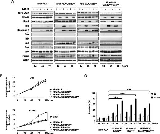 Figure 3. Deletion of Cdc42 or Rac1 increases apoptosis mediated by Bid upregulation. (A) Representative western blots of immortalized NPM-ALK lymphoma cell lines obtained from mice with the indicated genotypes. Cells were transduced by retroviruses expressing an inducible CreERT2 recombinase system and selected using 25 μg/mL blasticidin for 6 days. Cre recombinase was shortly activated by treatment with 10 nM 4-hydroxytamoxifen (4-OHT) for 4 hours to induce deletion of the floxed genes. Cells were collected 24, 48, and 72 hours after 4-OHT induction, lysed, and blotted with the indicated antibodies. Data are from 1 representative cell line for each genotype out of 3 NPM-ALK, 5 NPM-ALK;CreERT2;Cdc42fl/fl, 4 NPM-ALK;CreERT2;Rac1fl/fl, and 3 NPM-ALK;CreERT2;Cdc42fl/fl;Rac1fl/fl cell lines transduced with CreERT2 recombinase. (B) NPM-ALK lymphoma cell lines obtained from mice with the genotypes as in panel A and expressing CreERT2 were conditionally deleted of the indicated floxed genes by treatment with 10 nM 4-OHT for 4 hours as described above. Cell growth/viability were measured by CellTiter-Glo at the indicated time points. Data are presented as mean ± SD of triplicate experiments, each performed with 3 independent cell lines for each genotype. (C) Percentages of apoptotic cells measured by TMRM staining at the indicated time points in NPM-ALK immortalized lymphoma cells from mice with the indicated genotypes after CreERT2 induction of the floxed genes as described above. Data are indicated as means ± SD of triplicate experiments, each performed with 3 independent cell lines for each genotype. ***P < .001.