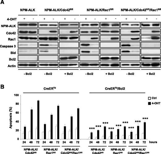 Figure 4. Bcl2 overexpression blocks apoptosis, Bid upregulation, and caspase-3 activation associated with Cdc42 and Rac1 deletion in NPM-ALK lymphoma. Three independent CreERT2 lymphoma cell lines for each indicated genotype as in Figure 2 were transduced with a retrovirus expressing Bcl2 and GFP as reporter. Percentages of transduced cells were calculated by GFP positivity in flow cytometry and were above 90% in all cell lines. Cdc42 and Rac1 deletions were induced by treatment with 10 nM 4-hydroxytamoxifen for 4 hours. (A) Cells were collected at the indicated time points and lysed, and western blots were performed with the indicated antibodies. (B) Overexpression of Bcl2 rescues apoptosis induced by Cdc42 or Rac1 deletion. Three independent CreERT2 lymphoma cell lines for each indicated genotype as in panel A were transduced with a retrovirus expressing Bcl2 and GFP. Cdc42 or Rac1 deletion was induced by 4-OHT treatment as described above. Analysis of apoptosis was carried out by TMRM staining and flow cytometry at the indicated time points. Data are indicated as mean ± SD of triplicate experiments, each performed with 3 independent cell lines for each genotype. P values are calculated by comparing control (Ctrl) vs 4-OHT–induced cells at each indicated time point (***P < .001).