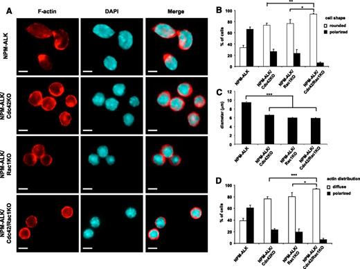 Figure 5. Control of NPM-ALK lymphoma cell shape by Cdc42 or Rac1. NPM-ALK, NPM-ALK;Cdc42fl/fl, NPM-ALK;Rac1fl/fl, and NPM-ALK;Cdc42fl/fl;Rac1fl/fl lymphoma cell lines were immortalized from primary tumors arising in mice with the indicated genotype. Cells were transduced with CreERT2 and Bcl2 retroviruses and then conditionally deleted for the indicated floxed genes by treatment with 10 nM 4-hydroxytamoxifen for 4 hours as described above. Stable cell lines were obtained by culturing deleted cells for at least 3 weeks. (A) Cell morphology and cell shape were evaluated by immunofluorescence using phycoerythrin-conjugated phalloidin staining to detect actin filaments. Scale bar, 5 μm. NPM-ALK;CreERT2 (NPM-ALK), NPM-ALK;CreERT2;Cdc42fl/fl;Bcl2 (NPM-ALK/Cdc42KO), NPM-ALK;CreERT2;Rac1fl/fl;Bcl2 (NPM-ALK/Rac1KO), NPM-ALK;CreERT2;Cdc42fl/fl;Rac1fl/fl;Bcl2 (NPM-ALK/Cdc42/Rac1KO). (B-D) Histograms represent the percentage of round versus polarized cells expressed as cell shape (B), average diameter (C), and actin distribution around the membrane or in the lamellipodial membrane protrusion (D). Each quantification was obtained by counting at least 100 cells for each condition. Two independent lymphoma cell lines for each genotype were studied in triplicate experiments. Error bars indicate SEM. ***P < .001; **P < .002; *P < .05.