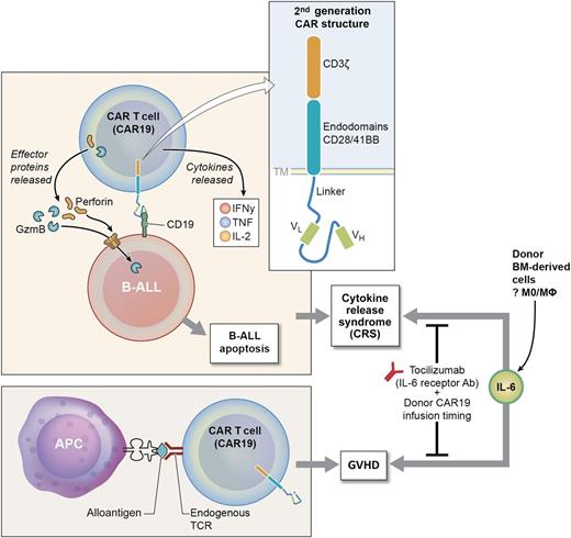 Allogeneic CAR T cells: balancing antitumor vs graft host disease. BM donor CAR T cells directed to CD19 (CAR19) recognize CD19 on B-ALL cells and release effector proteins (perforin and granzyme B) inducing B-ALL apoptosis. Cytokines (in particular IL-6) can be released at high levels, inducing CRS, a serious clinical toxicity. In addition, a subset of donor CAR19 cells (mostly CD4+ CAR19) recognize host alloantigen and induce GVHD. Data from Jacoby et al, and others, indicate both GVHD and CRS can be alleviated by careful timing of the donor CAR19 infusion and using the IL-6R antibody (tocilizimab). APC, antigen-presenting cell; IFNγ, interferon γ; TCR, T-cell receptor. Professional illustration by Ken Probst, XavierStudio.