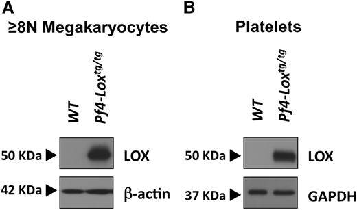 Figure 1. A mouse model expressing LOX in megakaryocytes and platelets. Immunoblot analysis of LOX expression in megakaryocytes (A) and platelets (B) of Pf4-Loxtg/tg mice and matching WT mice, generated as described under “Methods.” Megakaryocytes were purified by an albumin gradient, which enriches for large megakaryocytes ≥8N megakaryocytes. β-actin or glyceraldehyde-3-phosphate dehydrogenase (GAPDH) were used as loading controls.