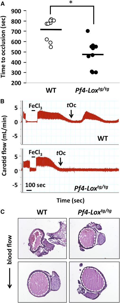Figure 3. Expression of LOX in platelets affects thrombosis. (A) Carotid artery injury model of vascular thrombosis in WT (n = 9) and Pf4-Loxtg/tg (n = 11) mice. Time to occlusion for each mouse is shown. *P < .001 by Student t test, difference of group means. (B) Representative flowchart of carotid artery blood flow. Interval of placement of filter paper soaked with FeCl3 and time to occlusion (tOc) are indicated. (C) Typical images from serial sections of thrombi in carotid arteries. The thrombus is delineated with a dotted white line. Top images show thrombi in regions of carotid artery upstream from the injury site. The direction of the blood flow is denoted. Bottom images represent areas closer to the site of FeCl3 injury (see “Methods”). Between 100 and 300 sections were stained and analyzed per mouse, using 11 Pf4-Loxtg/tg mice and 8 WT mice.
