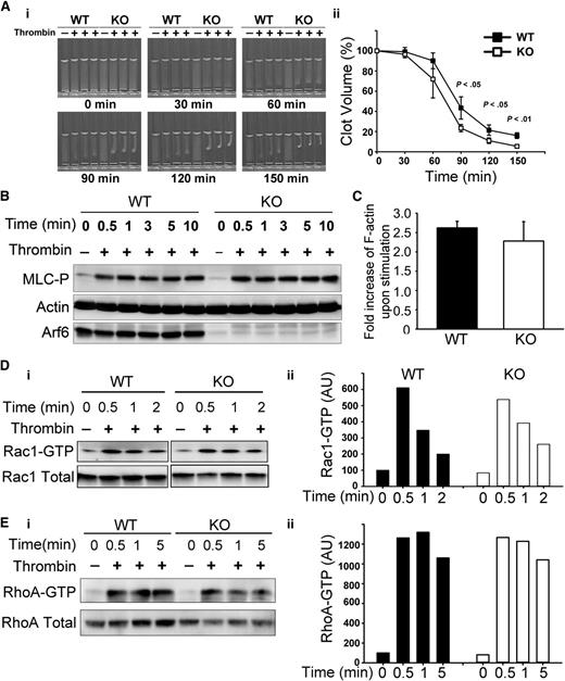Figure 5. Arf6 KO platelets have enhanced platelet clot retraction without noticeable defect on myosin light-chain phosphorylation (MLC-P), actin polymerization, or Rac1/RhoA activation. (A) Washed platelets from WT and KO mice (3 × 108/mL) were supplemented with 0.5 mg/mL human Fg and 1 mM Ca2+. Clot retraction was initiated with thrombin (0.1 U/mL), and images were taken at the indicated times (i) and quantified (ii). Clot size in panel A was measured using Image J v1.48 and normalized to clot size at time 0 (clot volume %). The data are representative of at least 5 independent experiments. (B) KO mice showed no defect in MLC-P upon thrombin stimulation. Washed platelets from WT and KO mice were prepared at 4 × 108/mL in HEPES Tyrode buffer (pH 7.4) and kept resting or stimulated with thrombin (0.1 U/mL) for the indicated times. The reaction was stopped by addition of sodium dodecyl sulfate–polyacrylamide gel electrophoresis sample buffer containing both protease inhibitor and phosphatase inhibitor cocktails. The lysates were probed for MLC-P by western blotting. β-Actin was used as a loading control. The blots shown are representative of at least 3 independent experiments. (C) Arf6 deletion did not affect thrombin-induced F-actin formation. Resting and thrombin-stimulated platelets (2 × 107) were fixed and permeabilized with Triton X-100 in the presence of tetramethylrhodamine (TRITC)-phalloidin. The bound TRITC-phalloidin was solubilized and measured using a microplate spectrofluorimeter. The data are representative of 2 independent experiments. (D-E) KO platelets showed no defect in Rac1/RhoA activation. Washed platelets (5 × 108/mL) from WT and KO mice were kept resting or stimulated with thrombin (0.1 U/mL) for the indicated times. The reactions were stopped by addition of 2× GTPases-pulldown lysis buffer containing a protease inhibitor cocktail. Rac1-GTP/RhoA-GTP were recovered as described in “Methods.” (Di and Ei) Western blotting of the pellets (Rac1-GTP or RhoA-GTP) and the supernatant (total Rac1 or total RhoA). (Dii and Eii) Quantification of Rac1-GTP/total Rac1 and RhoA-GTP/total RhoA. Quantification was performed using ImageQuantTL, and the ratio of Rac1-GTP/total Rac1 or RhoA-GTP/total RhoA was plotted in a bar graph. Blots shown are representative of at least 2 independent experiments.