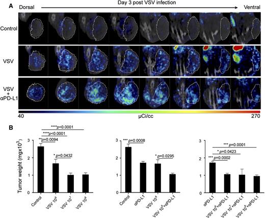 Figure 1. VSV therapy in subcutaneous C1498 tumors. (A) Representative SPECT/CT images of tumors (circled) in mice (n = 3 per group) that received VSV-mIFNβ-NIS, with and without anti-PD-L1 Ab (given 6 hours later). Eight serial sections through similar locations of the same mouse reveal NIS expression in VSV infectious foci distributed throughout the tumor. (B) Dose-dependent study on antitumor activity of VSV-mIFNβ-NIS against subcutaneous C1498 tumors. Mice were harvested 30 days post-tumor cell implantation and tumors were weighed. Mean ± SEM (n = 5 mice) from each group is plotted. *P ≤ .05. Unpaired Student t test was used. SEM, standard error of the mean.