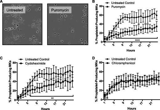 Figure 1. Protein synthesis inhibition significantly reduces proplatelet formation. Mature, primary murine megakaryocytes were cultured for 24 hours in the IncuCyte system. (A) Representative images of 10-hour time point, ×20 original magnification. (B-D) Rate and extent of proplatelet production were measured in ImageJ. Cells ≥330 µm2 were categorized as (1) round-megakaryocytes (circularity ≥0.4) or (2) proplatelet-producing megakaryocytes (circularity <0.4), and objects were normalized to initial (day 4) object counts and expressed as percentage of proplatelet-producing megakaryocytes. MKs were cultured with (B) puromycin (250 μg/mL, final), (C) cycloheximide (50 μg/mL, final), or (D) chloramphenicol (250 μg/mL, final); n = 3 biological replicates. The scale bar represents 50 um. **P < .005; ****P < .0001.