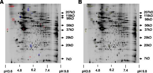 Figure 2. Proteomic analysis reveals that MARCKS is upregulated in proplatelet-producing MKS. Representative labeled spot maps of murine megakaryocytes cultured for 24 hours ± puromycin (250 μg/mL, final). (A) Gel showing 1.5× or greater differences in spot volume ratio. Blue = increase in Cy5/Cy3 (Puromycin/Untreated), red = increase in Cy3/Cy5 (Untreated/Puromycin). (B) All picked spots to date; of these, the 7 spots with the highest fold difference were subject to MS/MS analysis.