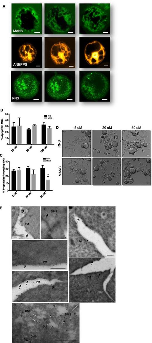 Figure 4. MANS peptide binds to MARCKS and inhibits proplatelet formation. (A) Live MKs at day 4 were treated with either MANS peptide specific for MARCKS (100 μg/mL) RNS control peptide (100 μg/mL) or Di-8-Anepps to highlight the demarcation membrane. Confocal microscopy was performed with a Leica SP5X Laser Scanning Confocal Microscope equipped with a 63Χ (N.A. = 1.4) Plan-Apo oil immersion objective, and a white light laser. Images were obtained and analyzed using the Leica Applications Suite Advanced Fluorescence, version 2.6.6. MANS and ANEPPS are localized to DMS, whereas the control peptide, RNS, is nonspecific and punctated throughout the MK. (B) Apoptosis and (C) Proplatelet formation after treatment with MANS and RNS peptides (n = 5; *P < .01). (D) Representative images; scale bar represents 10 μm. (E) Immunogold transmission electron microscopy showing MARCKS labeling along the plasma membrane (PM) and demarcation membrane invaginations (DMS). Scale bars represent 500 nm.