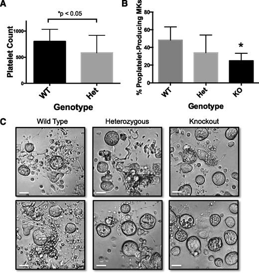 Figure 7. MARCKS heterozygous mice and KO MKs have impaired platelet formation. (A) Platelet counts were measured from adult, male MARCKS heterozygous (Het) and wild-type (WT) mice, as described (n = 15 mice per group; *P < .05, compared with WT). (B) Primary murine MKs were cultured as previously described after being isolated from MARCKS KO mice. Proplatelet formation was quantified 24 hours after MK gradient isolation (n = 5-6 fetal livers per condition; *P < .05, compared with WT). (C) Representative images of 24-hour time-point (original magnification ×20); scale bar represents 50 μm.