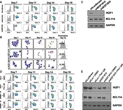 Figure 4. Loss of IKZF1 alone is insufficient to recapitulate the effects of pomalidomide treatment. CD34+ cells were transduced with either control (luciferase) or IKZF1 lentivirus, and after this were placed in erythroid differentiation media ± 1 μM pomalidomide (N = 3). Puromycin selection was performed at 48 hours post-transduction. (A) Terminal erythroid differentiation was assessed as described. (B) Representative May-Grunwald Giemsa–stained cytopreps, and enucleation rate as determined by Syto-16 staining. (C) Western blots for IKZF1 and BCL11A at day 7 of culture. (D) Terminal differentiation of shIKZF1 knockdown in the presence of 1 μM pomalidomide. (E) Immunoblots for IKZF1 and BCL11A at day 11.