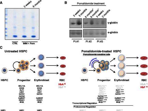 Figure 7. Red blood cells from MM patients treated with pomalidomide show increased levels of γ-globin and proposed model. Whole-blood samples were obtained from MM patients treated with pomalidomide for varying doses and durations. (A) Coomassie gel staining of normal hematologic control vs MM patients treated with pomalidomide. (B) Expression levels of α- and γ-globin chains in RBCs derived from 3 MM patients treated with pomalidomide for different periods of time. The asterisk next to the time points for patient #2 denotes that the patient interrupted treatment during the time course of the study. (C) Proposed model: In the absence of pomalidomide, adult hematopoietic progenitors differentiate to erythroid progenitors that express BCL11A, SOX6, KLF1, LSD1, GATA1, GATA2, CoREST, HDAC1, and Mi2β. Erythroid progenitors downregulate GATA2 as they progress to terminal erythroblasts. High expression of these factors in erythroid progenitors (bold text) and erythroblasts lead to RBCs containing predominantly HbA with low levels of HbF (shaded text). In the presence of pomalidomide, there is an immediate loss of IKZF1 via proteasomal degradation in HSPCs and erythroid progenitors. However, this post-translational regulation of IKZF1 is independent of the transcriptional/post-transcriptional reprogramming event that we observe in erythroid progenitors, whereby the expression levels of key γ-globin repressors are reduced. This regulation is highly selective because HDAC1, CoREST, GATA2, and mi2β exhibit normal expression. As reprogrammed progenitors mature into erythroblasts, GATA2 is lost, the levels of BCL11A and SOX6 remain decreased, and KLF1, LSD1, and GATA1 expression normalizes. Ultimately, macrocytic (indicated by larger size) RBCs containing high amounts of HbF are produced.