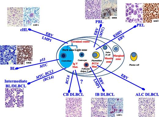 Figure 1. Main viral and molecular pathogenic pathways. Lymphomas in patients infected with HIV are heterogeneous, not only pathologically but also in terms of pathogenetic pathways and cellular derivation. The molecular pathway in HIV-associated BL involves activation of MYC (100% of cases), inactivation of p53 (50%-60% of cases), and infection by EBV (30%-50% of cases). Unclassifiable lymphomas with features intermediate between BL and DLBCL may occur. Molecular studies have shown rearrangements in BCL2 (and BCL6) and MYC genes. The molecular pathogenesis of HIV-associated centroblastic (CB) and immunoblastic (IB) DLBCL is complex and more heterogeneous. Infection with EBV occurs in 30% of DLBCL with CB morphology and 90% of DLBCL with IB and anaplastic (ALCL) morphology. Many EBV-positive IB DLBCLs express the EBV-encoded transforming protein LMP-1. There is an association between molecular changes in the BCL6 proto-oncogene and 20% of HIV-associated CB DLBCLs. Molecular studies of cells in PEL have shown no rearrangements in BCL1, BCL2, BCL6, and MYC genes. However, mutations in the BCL6 5′ noncoding region are common in PEL. In addition to consistent infection by KSHV, PELs are also commonly infected by EBV (80%). Regarding the molecular pathogenesis of PBL of the oral cavity type, EBV infection of the neoplastic clone has been frequently reported. In HIV-infected patients, nearly all cases of cHL are associated with EBV infection and express LMP-1.
