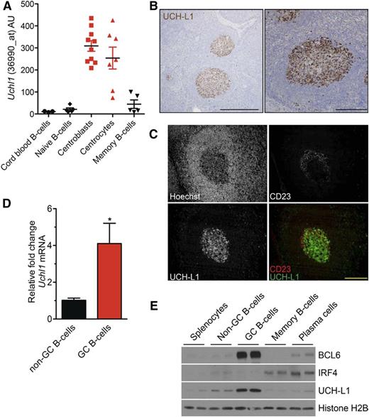 Figure 2. UCH-L1 is specifically induced in GCBs. (A) The expression of UCHL1 as reflected in RNA microarray data are shown for the indicated purified human B-cell subsets. Data extracted from GSE2350.13 (B) Formalin-fixed paraffin-embedded human reactive lymph node specimens were stained for UCH-L1 (brown). Bar: 500 μm (left), 200 μm (right). (C) Formalin-fixed paraffin-embedded human tonsil sections were stained with the indicated. Bar: 200 μm. (D) Quantitative real-time PCR for murine Uchl1 was performed on complementary DNA generated from GC or non-GCBs purified from wild-type mice (n = 3 each); *P < .05. (E) Extracts were prepared from the indicated purified B-cell subsets (n = 2 each), and samples were immunoblotted for the indicated proteins. Histone H2B is included as a loading control. Microscopy images were obtained with an Olympus AX70 microscope with a DP71 camera.