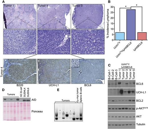 Figure 3. Transgenic UCH-L1 synergizes with deregulated BCL6 in the development of B-cell lymphoma. (A) Representative histology of lymphomas observed in Uchl1Tg/IμHABCL6 mice. Formalin-fixed paraffin-embedded sections were stained with hematoxylin and eosin (top 2 rows) or immunohistochemistry (bottom row) with antibodies against the indicated antigens. Bar: 1000 μm (top row), 100 μm (middle row), 400 μm (bottom row), 100 μm (inset, bottom row). Microscopy images were obtained with an Olympus AX70 microscope with a DP71 camera. (B) The incidence of lymphomas is shown for the indicated mouse strains. *P < .05 as determined with the χ2 test; N = 29 mice for each genotype. (C-D) Immunoblots were performed on extracts from lymphomas as in panel A. Comparison is made with purified B cells (C), purified GCBs (D) from the spleens of wild-type littermates, or the indicated GCB-DLBCL cell lines (D). (E) Genomic DNA was extracted from the indicated samples and subjected to PCR amplification of immunoglobulin variable regions. The arrows denote unique monoclonal bands not seen in the polyclonal B cells.