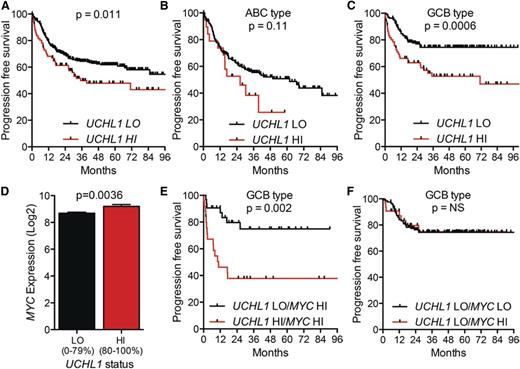 Figure 5. High levels of UCHL1 predict poor outcomes in patients with GCB-DLBCL treated with R-CHOP. (A-C) PFS for all patients with paired gene expression and survival data from the International DLBCL Rituximab-CHOP Consortium Program study (n = 470) (A), those with ABC-DLBCL (n = 199) (B), and GCB-DLBCL (n = 227) (C). UCHL1 was stratified with LO (=0%-80%) HI (=80%-100%) based on the entire cohort. P values were determined using the Mantel-Cox log-rank test. (D) The level of MYC mRNA is shown for the entire cohort from panel A including those lacking survival data (n = 498). UCHL1 stratification as in panels A-C. P value was determined using the Student t test. (E-F) PFS of patients with GCB-DLBCL (n = 227) with paired gene expression and survival data based on the stratification of UCHL1 and MYC. UCHL1 was stratified as above. MYC was stratified with LO (=0%-75%) and HI (=75%-100%). Data extracted from GSE31312 and analyzed using the R2: Genomics Analysis and Visualization Platform (http://r2.amc.nl).