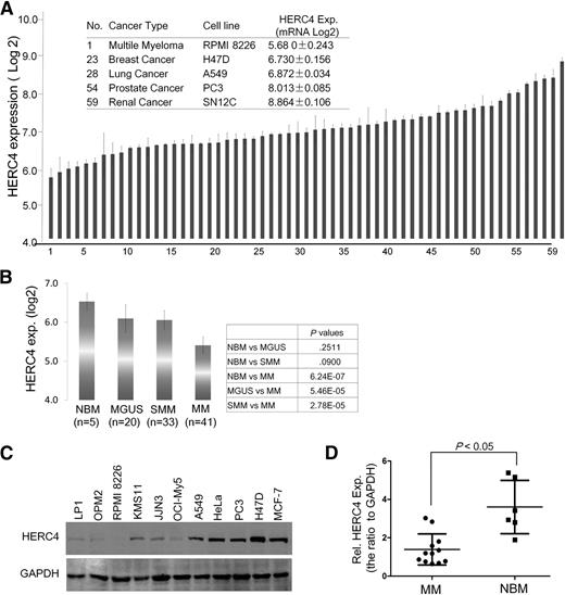 Figure 6. HERC4 is downregulated in MM cells. (A) The HERC4 expression profile in 60 NCI cell lines. #1 was RPMI 8226, a typical MM cell line. These data were retrieved from GEO dataset (http://www.ncbi.nlm.nih.gov/gds/). (B) HERC4 expression in the process of MM development. HERC4 expression levels were retrieved from a DNA microarray with 99 primary bone marrow samples including normal donors, MGUS, SMM, and MM patients. (C) Selected solid-tumor cell lines and MM cell lines were subjected to IB against HERC4. (D) Primary bone marrow cells from MM patients and healthy donors were applied for the evaluation of HERC4 RNA expression by reverse-transcription PCR followed by density analysis with ImageJ software.