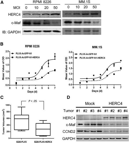 Figure 7. HERC4 decreases MM cell proliferation and delays MM tumor growth in nude mice. (A) RPMI 8226 and MM1.S cells were infected with increased pLVX-HERC4 lentivirus. Cells were subjected to IB for the expression of HERC4 and c-Maf. (B) RPMI 8226 and MM1.S cells were infected with HERC4 lentivirus followed by MTT assay for cell viability. (C) RPMI 8226 cells infected with HERC4 or mock lentivirus were injected into SCID mice subcutaneously. Tumor weights were then measured at the end of the experiment. (D) Tumor samples from the myeloma xenografts were subjected to IB analysis for c-Maf, HERC4, and cyclin D2 with specific antibodies.