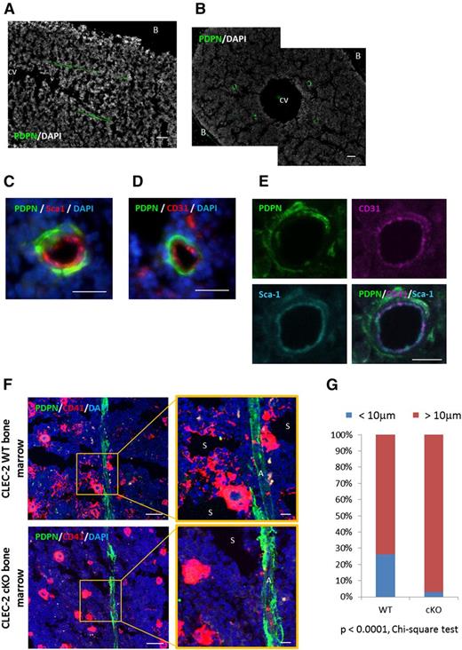 Figure 2. Megakaryocytic colonies developed in contact with PDPN-expressing arteriolar pericytes in the BM. (A-B) Representative images of longitudinal (A) and transverse (B) femurs with anti-PDPN and DAPI staining. (C-E) Representative images of BM vasculature ensheathed in PDPN+ stromal cells staining with PDPN/Sca-1/DAPI (C), PDPN/CD31/DAPI (D), and PDPN/CD31/Sca-1 (E). (F) Representative IHC images of the CLEC-2 WT and CLEC-2 cKO BM staining with CD41, PDPN, and DAPI. In CLEC-2 WT BM, CD41+ megakaryocyte clusters located adjacent to PDPN+ stromal cells at periarteriolar sites in the BM. (G) Percentage of megakaryocytes and megakaryocytic colonies which associated with PDPN+ stromal cells at periarteriolar space in the CLEC-2 WT and cKO BM. CD41+ nucleated cells and colonies localizing within 10 μm distance from PDPN+ stromal cells were defined as the megakaryocytes or immature megakaryocytic colonies associated with arteriole. Data were obtained using frozen BM sections from 3 individual CLEC-2 WT or CLEC-2 cKO mice. Scale bars, 100 μm for A and B; 50 μm for C, D, and F; 10 μm for E and magnified image in panel F. A, arteriole; B, bone; CV, central vein; S, sinusoid.
