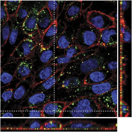 Figure 2. DF internalization by SK cells. Merged confocal images of all individual channels (red staining with wheat germ agglutinin for membranes, blue with Hoechst for nuclei, and green with Alexa 488 for DF), and Z projection (narrow images in the right and in the bottom of the main picture) show that DF remains in the cytoplasm displaying vesicular staining and does not enter into the nuclei, at least after 24 hours of incubation. Confocal images were taken using a Leica TCS SP5 microscope and a 63× oil immersion objective. Optical sections (z) were performed each 2 μm. Image analysis was performed using Fiji software (National Institutes of Health).