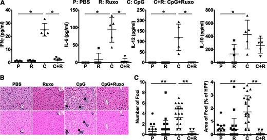 Figure 2. Ruxolitinib treatment reduces CpG-induced hypercytokinemias and ameliorates liver inflammation. (A) Serum cytokine levels were assessed on day 9. (B) H&E-stained liver sections demonstrate inflammatory infiltrates (dark purple clusters), indicated by arrows. Representative sections are shown at a magnification of ×20 (top panels) and following computer analysis of inflammatory area (bottom panels). (C) The number of inflammatory foci (left) and percent area occupied by inflammatory foci with respect to the high-power field (HPF) of view (right) was determined by computer analysis of histologic samples. Symbols in panel A represent individual mice in each treatment group where in panel C they represent the number of, or area encompassed by, inflammatory foci (clusters containing >8 lymphocytes) per ×20 field of view. Data shown are mean ± SD and are representative of 3 independent experiments. *P < .05; **P < .001.