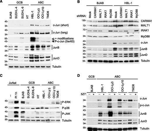 Figure 1. Upregulation of c-Jun and JunB in ABC DLBCL cell lines is CARMA1-, MALT1-, MyD88-, IRAK1-, and TAK1-dependent. (A) Analysis of c-Jun, JunB, and JunD protein expression and c-Jun phosphorylation on Ser 63 in GCB and ABC cell lines by western blot. (B) Analysis of c-Jun, JunB, and JunD protein expression in lysates of HBL-1 (ABC) and BJAB (GCB) cell lines transduced with control small hairpin RNA (shRNA) or with CARMA1-, MALT1-, IRAK1-, or Myd88-specific shRNA. Silencing efficiency was assessed by western blot analysis using anti-CARMA1, anti-MALT1, anti-IRAK1, and anti-MyD88 antibodies. (C-D) Protein expression in GCB and ABC DLBCL cell lines was determined by western blot using the indicated antibodies. In panel C, we used lysates of Jurkat cells treated with PMA and ionomycin (PI) for 1 hour as a positive control for MAPK activation. In panel D, DLBCL cell lines of the GCB (BJAB), or ABC subtype (all others) were treated with the TAK1 inhibitor 5Z7 or with solvent alone for 24 hours. In all figure panels, blotting for tubulin served as a loading control. Data are representative of at least 3 (A-B) or 2 (C-D) independent experiments.