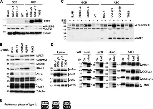 Figure 3. ATF3 is overexpressed and forms heterodimers with Jun subunits in ABC DLBCL cell lines. (A) Analysis of ATF3 and JDP2 protein expression in GCB and ABC cell lines was determined by western blot using ATF3 and JDP2 antibodies. Filled arrowhead indicates the position of phosphorylated JDP2; open arrowheads indicate nonphosphorylated JDP2. (B) Immunoblot analysis of lysates of HBL-1 (ABC DLBCL) and BJAB (GCB DLBCL) cell lines, transduced with control shRNA or with CARMA1-, MALT1-, IRAK1-, or MyD88-specific shRNA. Silencing efficiency was assessed by western blot analysis using anti-CARMA1, anti-MALT1, anti-IRAK1, and anti-MyD88 antibodies. ATF2, ATF3, ATF7 protein levels were assessed by western blot. Blotting for tubulin served as loading control in panels A and B. (C) Lysates of indicated ABC and GCB cell lines were treated with the cross-linker BS3 or with solvent alone for 1 hour at 4°C. Cross-linked (open arrowheads) and non–cross-linked (filled arrowheads) proteins were assessed by western blot using anti-ATF3 antibodies. White asterisk indicates the position of a nonspecific band detected by anti-ATF3. (D) ABC DLBCL cell lines were immunoprecipitated with anti-c-Jun, anti-JunB, anti-JunD, or anti-IRE1α antibodies (Ctr, control antibody). Immunoprecipitated proteins (IPs) were assessed with anti-c-Jun, anti-JunB, and anti-JunD antibodies, and coprecipitating proteins (co-IP) detected by anti-ATF3. *Heavy chain or light chain of the c-Jun, JunB, JunD, and control antibodies; filled arrowhead indicates ATF3 in the co-IP. (E) The composition of protein complexes of ATF3 with Jun family members (type 2 complexes) is depicted. Data are representative of 3 (A) and 2 (B-D) independent experiments.