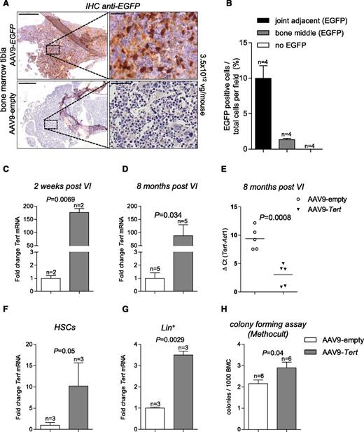 Figure 1. High dose of AAV9 particles targets bone marrow, including HSPCs. (A) Representative anti-EGFP immunohistochemistry (IHC) images of bone marrow corresponding to the tibia. Mice were injected with the AAV9-EGFP vector or AAV9-empty vector at a concentration of 3.5 × 1012 viral genomes (vg) per mouse. EGFP-positive cells were mainly located toward the end of the bones. Bars represent 500 μm (left) and 50 μm (right); hematoxylin and eosin stain. (B) Percentage of EGFP-positive cells relative to the total number of cells. Cells were separately counted in joint adjacent areas and in the middle of the bone. (C-D) Tert mRNA expression level in total bone marrow isolated 2 weeks (C) and 8 months (D) after VI with 3.5 × 1012 viral genomes per mouse. AAV9-Tert relative to the expression of mice injected with the same amount of AAV9-empty vector. (E) Δ Ct values (Tert minus Act1) of the quantitative real-time PCR shown in panel D. Quantitative real-time PCR determined relative Tert expression in HSPCs (HSCs) sorted by FACS (F) and lineage-committed cells (G). (H) Colony-forming assay in MethoCult with whole bone marrow cells isolated from mice injected with AAV9-Tert or AAV9-empty. For all experiments, n indicates number of mice. Data are mean ± SEM. Statistical analysis: 2-sided Student t test; P values are shown. SEM, standard error of the mean; VI, virus injection.