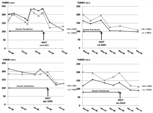 Figure 4. Velocities outcome after transplant in 4 patients who still had abnormal velocities on chronic transfusion. Velocities were rapidly normalized after transplant. HSCT, hematopoietic stem cell transplant; l.MCA, left MCA; r.MCA, right MCA.