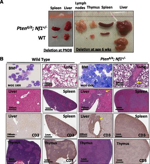 Figure 6. Significantly different phenotype in mice with Pten deletion induced at 6 weeks after birth in comparison with mice induced at PND8. (A) Photographs of organs from representative littermate mice with Pten deletion induced at PND8 (euthanized at age 3 weeks) or at age 6 weeks (euthanized at age 9 weeks). Hepatosplenomegaly and significant enlargement of lymph nodes and thymus are demonstrated in mice with PtenΔ/Δ; Nf1+/− induced at age 6 weeks. (B) Micrographs demonstrate BM with increased lymphoblasts and associated lymphocyte infiltration in the lung and liver (indicated by arrows), spleen, and thymus in mice with PtenΔ/Δ; Nf1+/−. BM cytospins were stained by MGG; lung with HE; liver, spleen, and thymus with HE and IHC with antibody against CD3. Images were acquired by an Aperio CS2 scanner (additional relevant FACS data are presented in supplemental Figure 6).