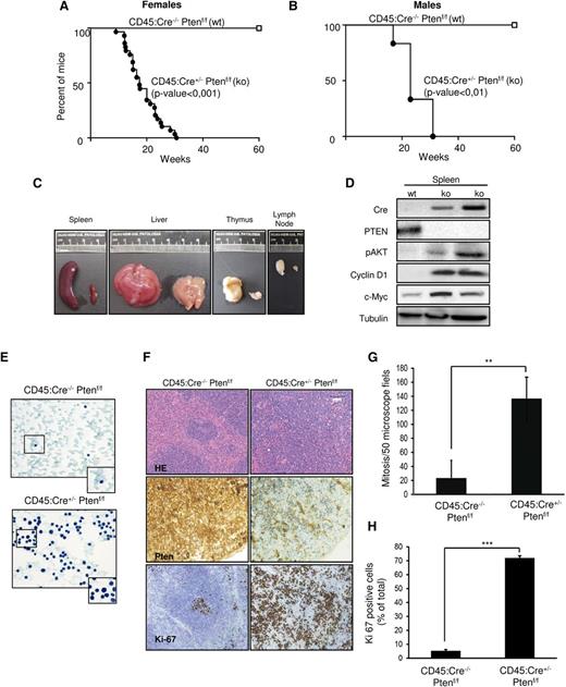 Figure 1. CD45:Cre+/−Ptenf/f develop lethal disease that affects lymphoid organs. (A-B) Kaplan-Meier curve of females and males analyzed for 60 weeks. Note that survival dramatically decreases after 20 weeks. (C) Macroscopic comparison of representative spleen, liver, thymus, and lymph nodes from CD45:Cre+/−Ptenf/f (ko, left) and CD45:Cre−/−Ptenf/f (wt, right). (D) Western blot from wt and ko spleens showing Cre recombinase expression, correlating with Pten loss and increased Akt phosphorylation (p-Akt), cyclin D1, and c-Myc levels. Membranes were reprobed with tubulin to ensure protein loading. (E) Representative images (×63) showing Papanicolau staining of blood extensions from CD45:Cre−/−Ptenf/f and CD45:Cre+/−Ptenf/f mice. (F) Representative images (×10) showing hematoxylin and eosin (H&E) staining and Pten and Ki-67 immunohistochemistry of spleens from CD45:Cre−/−Ptenf/f and CD45:Cre+/−Ptenf/f mice. (G-H) Quantification of mitotic activity and proliferation in spleens from CD45:Cre−/−Ptenf/f and CD45:Cre+/−Ptenf/f mice. Results are expressed as number of mitotic figures observed per 50 high-power microscope fields (G) and percent of total cells displaying nuclear staining for Ki-67 (H). Data are means ± standard deviation; **P ≤ .001; ***P ≤ .0001.