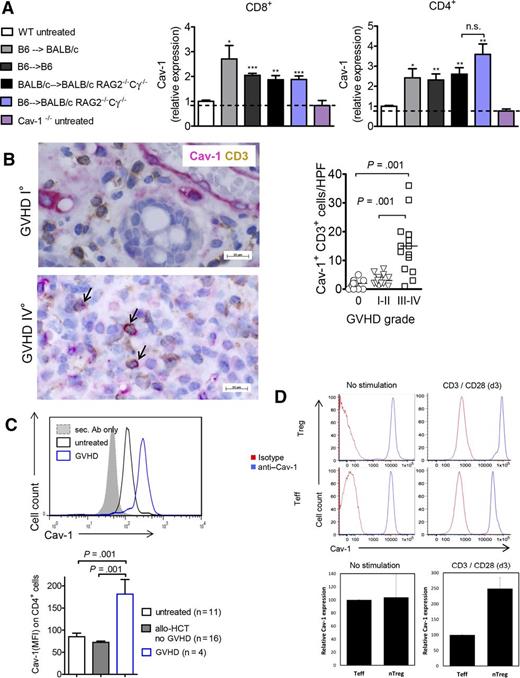Figure 1. Stimuli leading to Cav-1 expression in murine and human T cells. (A) Expression of Cav-1 in CD4+ or CD8+ T cells derived from mouse spleens under the indicated conditions as measured by flow cytometry (pooled from 2 experiments, n = 8). The mean fluorescence intensity (MFI) measured for Cav-1 on CD4+ or CD8+ T cells derived from untreated WT mice was set as “1,” and all values were set in relation to this group. The dotted line indicates the background MFI for Cav-1 that is detected in Cav-1−/− CD4+ or CD8+ T cells. WT BM and purified T cells were transplanted as follows: C57BL/6 cells into irradiated BALB/c mice (allogeneic), C57BL/6 cells into irradiated C57BL/6 mice (syngeneic), C57BL/6 cells into non-irradiated BALB/c Rag2−/−Cγ−/− mice (allogeneic and lymphopenia), and BALB/c cells into non-irradiated BALB/c Rag2−/−Cγ−/− mice (syngeneic and lymphopenia). Untreated WT or Cav-1−/− mice were used as controls. The analyses of the T cells were performed on day 7 after HCT. *P < .05; **P < .01; ***P < .001. (B) The number of CD3+ Cav-1+ T cells per HPF is shown within human intestinal biopsies detected by immunohistochemistry. The arrows indicate Cav-1/CD3 double positive cells. Samples from 18 patients were analyzed and different time points after allo-HCT (supplemental Table 1). (C) Expression of Cav-1 in CD4+ T cells derived from the PB of healthy controls and patients who underwent allo-HCT without or with acute GVHD. Representative histogram (top) and bar diagram of multiple patients (bottom). The human blood samples were analyzed at multiple time points after allo-HCT (supplemental Table 2). (D) Expression of Cav-1 in in vitro expanded naïve CD4+ T cells and naïve Tregs derived from human PB re-stimulated with anti-CD3/28 beads for 3 days. Representative histogram for effector T cells (Teff) and Treg cells (top) and quantification for both Treg and conventional CD4+ T cells (n = 3 each) (bottom). The blue lines are the anti–Cav-1 stained cells and the red lines are the isotype-stained cells. The Cav-1 MFI values were normalized in the Teff group (100%). HPF, high power field, n.s., not significant. Ab, antibody; nTreg, naturally occurring Treg.