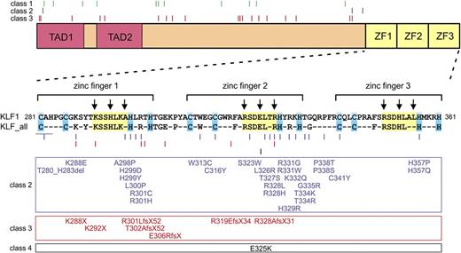 Figure 2. Functional domains of KLF1 and variants reported in the literature. The KLF1 protein (362 amino acids) contains two N-terminal transactivation domains (TAD1 and TAD2) which are required for it to work as a transcriptional activator. The 3 zinc fingers (ZF1, ZF2, and ZF3) located at the C terminus form the DNA-binding domain, which enables KLF1 to bind to specific sites in the genome, typically CACCC boxes and related GC-rich elements. Residues conserved in all human KLF factors are indicated. The cysteine and histidine residues involved in zinc coordination are highlighted in blue; residues contacting DNA are highlighted in yellow. The arrows point to residues making base-specific contacts thus recognizing KLF1-binding sites in the genome. Variants are color-coded: class 1, green; class 2, blue; class 3, red; class 4, black. See supplemental Table 1 for details and references.