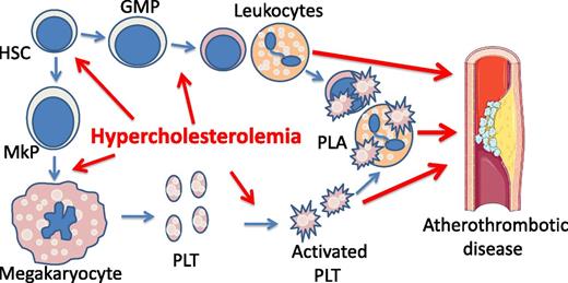 Figure 1. Hypercholesterolemia is a risk factor for atherothrombotic disease by promoting platelet production and activation. Hypercholesterolemia promotes megakaryopoiesis, platelet (PLT) biogenesis, and myelopoiesis, leading to leukocytosis. Hypercholesterolemia also increases platelet activation, likely by elevating platelet production and by direct impact on platelets. Activated platelets form PLAs, which are further increased in leukocytosis. PLA is an independent risk factor for atherothrombotic disease. GMP, guanosine monophosphate; HSC, hematopoietic stem cell; MkP, megakaryocyte progenitor cell.