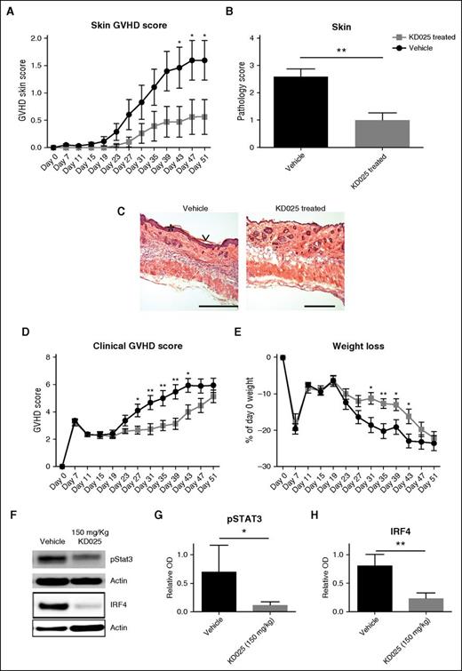 Figure 4. Reversal of clinical signs of sclerodermatous cGVHD with KD025 treatment. BALB/c mice were transplanted with B10.D2 BM and T cells and given either 150 mg/kg KD025 or 0.4% methylcellulose vehicle control starting after initial signs of cGVHD and harvested on day 51 following transplantation. (A) Clinical skin scores, (B) skin pathology, (C) highlights of pathology (*epidermal hyperplasia and ∨keratosis; bar, 500 μM), (D) clinical GVHD scores, and (E) percent weight loss. Whole spleens were assessed for Stat3 phosphorylation normalized to actin and expression of IRF4 (F and quantified in G and H, respectively). *P < .05; **P < .01. Error bars represent SEM; data from 2 separate experiments with n = 8 per group.