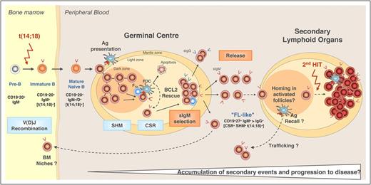 Figure 1. Model of FL pathogenesis. Naive B cells in the bone marrow (BM) acquire the t(14;18) translocation due an error in V(D)J recombination and subsequently home to B-cell follicles where they undergo the GC reaction. In the dark zone of the GC, the B cells proliferate as centroblasts and undergo somatic hypermutation (SHM) and class switching of their BCRs. Centroblasts then become smaller centrocytes and migrate to the light zone of the GC where they interact with follicular dendritic cells (FDCs) and are selected to either undergo apoptosis or rescue by follicular helper T cells (TFH) based on antigen (Ag) affinity of their BCRs. Ectopic expression of BCL2 provides mutant B cells with t(14;18) an avenue to escape apoptosis, independent of BCR affinity. These FL-like B cells then exit the GC and enter the circulation where they might be prone to traffic between follicles and/or the BM and have the opportunity to acquire additional genetic changes necessary for transformation to FL. Reprinted from Roulland et al3 with permission. CSR, class switching recombination; IgM, immunoglobulin M; sIgM, surface immunoglobulin M.