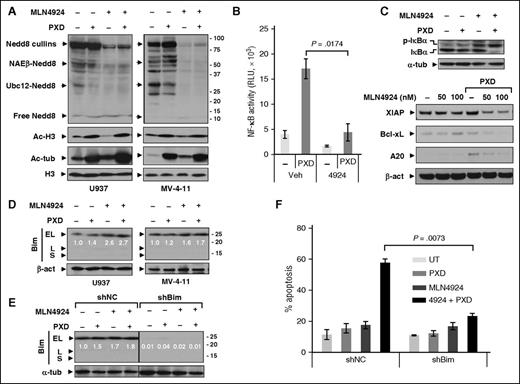 Figure 2. Coadministration of MLN4924 with belinostat disrupts NF-κB activation whereas Bim knockdown markedly attenuates apoptosis induced by this regimen. (A) U937 and MV-4-11 cells were exposed to PXD-101 (U937, 300 nM; MV-4-11, 200 nM) ± 100 nM MLN4924 for 24 hours, after which western blot analysis was performed using antibodies that specifically recognize neddylated (Nedd8) or acetylated (Ac) proteins. (B) U937 cells were incubated with 300 nM PXD-101 ± 100 nM MLN4924 for 16 hours, after which nuclear extracts were prepared and subjected to the TransAM NF-κB p65–DNA-binding enzyme-linked immunosorbent assay (ELISA) as per the manufacturer’s instruction. (C) Alternatively, total and S32/34 phosphorylated IκBα (top panels) as well as expression of NF-κB–dependent genes (bottom panels) were monitored by western blot analysis in U937 cells. (D) U937 and MV-4-11 cells were treated for 24 hours as described in panel A, after which western blot analysis was performed to monitor expression of the BH3-only proapoptotic protein Bim (including EL, L, and S isoforms). (E-F) U937 cells stably transfected with constructs encoding shRNA targeting human BCL2L11/Bim (shBim) or scrambled sequence as negative control (shNC) were treated with 300 nM PXD-101 ± 100 nM MLN4924 for 24 hours, after which western blot analysis and FCM were carried out to monitor Bim expression (E) and apoptosis (Annexin V, determined by flow cytometry) (F), respectively. For panels D and E, blots for BimEL were quantified using ImageJ software. Values indicate fold-increase of BimEL vs untreated control (arbitrarily set as 1.0), after normalization to β-actin or α-tubulin (α-tub). RLU, relative light unit; UT, untreated control.