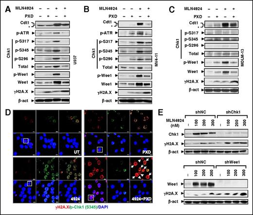 Figure 3. Belinostat attenuates activation of the ATR/Chk1/Wee1-mediated DNA damage checkpoint pathway by MLN4924. (A-C) Cells were treated (24 hours) with PXD-101 (U937, 300 nM; MV-4-11 and MOLM-13, 200 nM) ± 100 nM MLN4924, after which western blot analysis was performed to monitor expression of Cdt1 (top band, *nonspecific bands), total and/or phosphorylated ATR (S428), Chk1, Wee1 (S642), H2A.X (S139). (D) MV-4-11 cells were treated with 200 nM PXD-101 ± 100 nM MLN4924 for 16 hours, after which cytospin slides were prepared and stained with the primary antibodies against p-Chk1 (S345) and γH2A.X, followed by Alexa Fluor 488– or Alexa Fluor 594–conjugated secondary antibody. Images (×64) were captured using a Zeiss LSM 700 confocal laser-scanning microscope. Arrow, Cells containing γH2A.X foci with no or few p-Chk1 colocalization foci; arrowhead, apoptotic cells. (Top panels) Left, γH2A.X (red); middle, p-Chk1 (green); right, γH2A.X and p-Chk1 merged. (Bottom panels) Left, γH2A.X and DAPI merged; middle, p-Chk1 and DAPI merged; right, DAPI (blue). Scale bars, 10 μm. Squares indicate areas corresponding to images with higher magnification as shown in supplemental Figure 3F. (E) U937 cells were stably transfected with constructs encoding shRNA targeting human CHEK1/Chk1 (shChk1), Wee1 (shWee1), or scrambled sequence (shNC). Cells were then treated with the indicated concentrations of MLN4924 for 24 hours, after which western blot analysis was performed to monitor expression of Chk1, Wee1, and γH2A.X.
