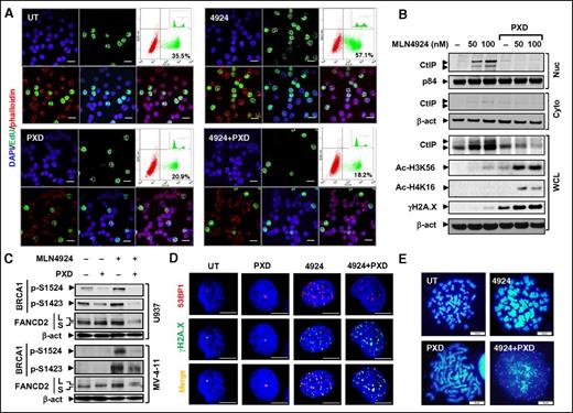 Figure 4. Cotreatment with MLN4924 and belinostat disrupts the intra-S-phase checkpoint and HR or NHEJ repairs. (A) MV-4-11 cells were treated with 200 nM PXD-101 ± 100 nM MLN4924 for 16 hours, after which cells were pulse-labeled with EdU for 30 minutes, followed by double staining for EdU and F-actin (Alexa Fluor phalloidin) with DAPI counterstaining. (Top panels) Left, DAPI (blue); middle, EdU (green); right, dot plot of FCM determining the percentage of EdU-positive cells (inset, histogram). (Bottom panels) Left, EdU and phalloidin (red) merged; middle, EdU and DAPI merged; right, EdU, phalloidin, and DAPI merged. Scale bars, 20 μm. (B) After exposure to 300 nM PXD-101 ± 50 to 100 nM MLN4924 for 16 hours, whole-cell lysates (WCL) and nuclear (Nuc) or cytosolic (Cyto) fractions of U937 cells were prepared and subjected to western blot analysis using the indicated antibodies. (C) MV-4-11 and U937 cells were treated as described in panels A and B, respectively, after which western blot analysis was performed to assess BRCA1 phosphorylation (S1524, S1423) and FANCD2 ubiquitination (S, an inactive unubiquitinated isoform; L, an active monoubiquitinated isoform). (D) U937 cells were incubated with 300 nM MLN4924 ± 100 nM PXD-101 for 16 hours, followed by double staining for 53BP1 (red) and γH2A.X (green) with DAPI counterstaining. Scale bars, 10 μm. (E) U937 cells were treated with 300 nM PXD-101 ± 100 nM for 16 hours, after which chromosome-spreading analysis (DAPI staining) was carried out to monitor chromosome morphology and pulverization, characterized by fragments of DAPI staining material that were clustered into a discrete location on the spread. Scale bars, 10 μm.