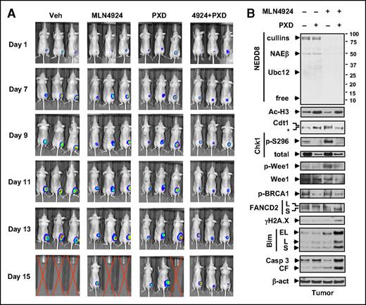 Figure 6. Coadministration of MLN4924 and belinostat suppresses tumor growth in a murine xenograft flank model. Nude mice were s.c. inoculated in the right rear flank with 5 × 106 luciferase-expressing U937 cells. Treatment was initiated after luciferase signal was detected. MLN4924 was reconstituted weekly with 20% HPbCD (HY-100; ONBIO) and administrated at a dose of 30 mg/kg via s.c. injection twice daily for 3 continuous days followed by 2 days off every 5 days. Stock solution of 50 mg/mL belinostat in 100 mg/mL l-arginine (Sigma A8094; belinostat: l-arginine = 1:2) was formulated and stored at −20°C. Belinostat stock solution was freshly diluted in isotonic saline and administrated at a dose of 40 mg/kg via i.p. injection daily 5 days a week. Control animals were administered equal volumes of vehicle. (A) Tumor growth was monitored every other day after i.p. injection with 150 mg/kg luciferin using the IVIS 200 imaging system. Representative images of 3 mice are shown. Red crossed lines indicate that mice were euthanized when tumor size reached 1700 mm3 or other humane end points (eg, abscessed or necrotic tumors) were reached. (B) Western blot analysis was performed to monitor the indicated candidate PD markers, identified from in vitro experiments, in tumors excised from representative mice.