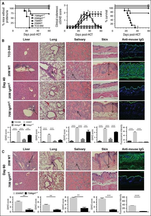 Figure 1. Antibody-producing donor B cells are not required to initiate tissue damage, but they are required for persistence of tissue damage. BALB/c recipients were lethally irradiated (850 cGy TBI) and given high-dose (75 × 106) and low-dose (25 × 106) CD25-depleted splenocytes and TCD-BM (2.5 x106) cells from WT or IgHμγ1 DBA/2 donors. Recipients given TCD-BM (2.5 × 106) from WT or IgHμγ1 DBA/2 donors alone were combined and used as negative controls for GVHD. Recipients were monitored for GVHD development, including proteinuria, clinical cutaneous GVHD, and survival († indicates death of all recipients in a group). (A) Percentage of mice without proteinuria, clinical cutaneous GVHD score, and percentage of survival; N = 8 from 2 replicate experiments. (B) On day 40 after HCT, histopathology of the GVHD target tissues liver, lung, salivary gland, and skin, and antibody deposition in the skin was evaluated. A representative photomicrograph (original magnification ×200 for histopathology and ×100 for IgG deposition); means ± standard error (SE) (N = 6) of histopathology scores are shown. Arrows indicate the following: infiltration in the liver, lymphocytic bronchiolitis, infiltration and loss of ductal structure in the salivary gland, and hyperplasia in the epidermis, expansion of dermis, and loss of subcutaneous fat. Antibody deposition in the skin was quantified by the intensity of anti-mouse IgG–fluorescein isothiocyanate (FITC) in 5 different levels of 4 examined mice at each group. (C) On day 60 after HCT, histopathology of the GVHD target tissues liver, lung, salivary gland, skin, and antibody deposition in the skin was evaluated. A representative photomicrograph (original magnification, ×200 for histopathology and ×100 for IgG deposition); means ± SE (N = 6) of histopathology scores or means ± SE (N = 4) of anti-IgG–FITC intensity are shown. Arrows are described in panel B (**P < .01, ***P < .001, ****P < .0001).