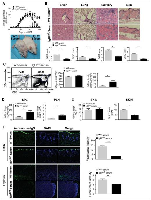 Figure 6. Injections of IgG-containing sera from WT-cGVHD recipients lead to tissue deposition of IgG and persistence of cGVHD in IgHµγ1-transient-cGVHD recipients. BALB/c recipients were lethally irradiated (850 cGy, TBI) and given CD25-depleted splenocytes (75 × 106) and TCD-BM (2.5 × 106) cells from IgHμγ1 DBA/2 donors to set up IgHµγ1-transient-cGVHD recipients. Sera were harvested from WT-cGVHD or IgHµγ1-no-cGVHD recipients at 30 to 45 days after HCT. Serum aliquots (250 µL) were injected IV into IgHµγ1-transient-cGVHD recipients at 40, 45, 50, and 55 days after HCT. Recipients were monitored for cGVHD development for up to 60 days after HCT. N = 8 from 2 replicate experiments. (A) Clinical cutaneous GVHD scores. A representative photograph taken at day 60 is shown. (B) Histopathology of the GVHD target tissues liver, lung, salivary gland, and skin was evaluated. A representative photomicrograph (original magnification, ×200); means ± SE of histopathology scores from 6 recipients are shown. Arrows indicate infiltration in the liver, lymphocytic bronchiolitis, infiltration and loss of ductal structure in the salivary gland, hyperplasia in the epidermis, expansion of dermis and loss of subcutaneous fat. (C) Representative flow cytometry patterns of CD4+CD8+ double-positive thymocytes, and means ± SE of percentages and yields of double-positive thymocytes are shown. N = 4. (D) Yield of donor CD5.1+TCRβ+CD4+ T in the spleen and PLNs (means ± SE, N = 4). (E) Percentages of donor CD5.1+IFN-γ+CD4+ and CD5.1+IL-17+CD4+ T cells (means ± SE, N = 4-6). (F) Histoimmunofluorescent staining of mouse IgG (green) and DAPI (blue, nucleus) in thymus and skin sections. A representative photomicrograph (original magnification, ×100) and means ± SE (N = 4) of fluorescent intensity are shown (* P < .05, ** P < .01, ***P < .001).