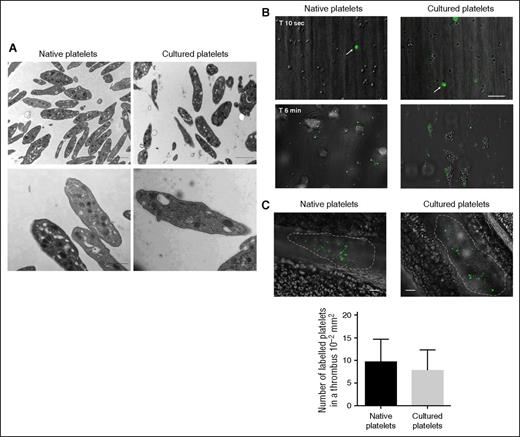 Figure 5. Ultrastructure, in vitro, and in vivo functionality of platelet-like elements produced in the presence of SR1. (A) Platelet ultrastructure. (Upper) Representative microscopic fields of resting platelet populations examined by TEM. Bar, 2 µm. (Lower) Higher-magnification TEMs of native and culture-derived platelets. Bar, 1 µm. Culture-derived platelets exhibited similar ultrastructural characteristics to native platelets. (B) Flow-dependent thrombus formation. RAM.1-488–labeled native or culture-derived platelets mixed to hirudin-anticoagulated blood at a 1:100 ratio were perfused over immobilized type I collagen at 300 seconds−1 and observed in real time by DIC. (Upper) Individual labeled platelets (arrows) adhering to the matrix after 10 seconds of perfusion. (Lower) Platelet thrombi formed after 6 minutes of perfusion showing incorporation of labeled native and cultured platelets. Scale bars, 20 µm. (C) Laser-induced thrombosis model. Representative images of thrombi 2 minutes after laser injury of a mesenteric artery showing incorporation of RAM.1-488–labeled native or culture-derived platelets injected immediately after lesion. Scale bars, 20 µm. Bar graph, number of labeled platelets per thrombus (mean ± SEM of 4 experiments).