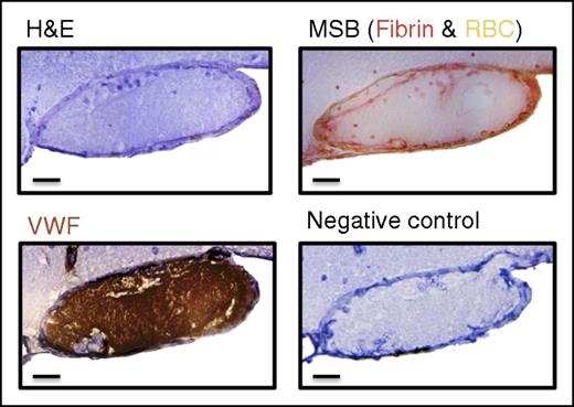 Figure 3. FeCl3-induced thrombotic occlusion of the right MCA is VWF-rich. Histological analysis of the induced MCA thrombus 5 minutes after occlusion via H&E, MSB, and VWF staining revealed a VWF-rich, fibrin-poor thrombus. Scale bar: 20 μm.