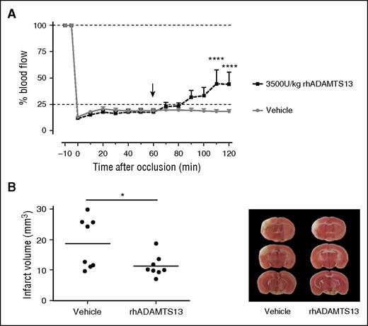 Figure 6. Delayed rhADAMTS13 administration 60 minutes after occlusion is able to restore MCA blood flow and reduce ischemic brain injury. A large thrombus was generated in the right MCA of C57Bl/6J mice. Sixty minutes after inducing a stable MCA occlusion, mice were treated with either rhADAMTS13 (3500 U/kg) or vehicle (arrow). MCA blood flow was monitored via laser Doppler flowmetry to assess recanalization of the MCA until 1 hour after injection. (A) In mice treated with rhADAMTS13, a significant increase in blood flow was observed. (B) Infarct sizes were significantly decreased in mice that received rhADAMTS13. Quantification of the infarct sizes is shown in the left panel, and representative brain sections are shown in the right panel. (n = 8 mice for each group; *P < .05; ****P < .001 compared with vehicle.)