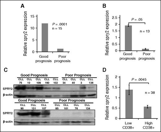 Figure 1. Comparison of SPRY2 levels in CLL cells from good- and poor-prognosis patients. To compare the expression of SPRY2, CLL cells were isolated from PB of good- and poor-prognosis patients. (A) Relative messenger RNA level of spry2 from transcriptome analyses of 7 good-prognosis and 8 poor-prognosis CLL patients (n = 15). RNA isolated from PB CLL cells was used for sequencing. The expression was normalized with glyceraldehyde-3-phosphate dehydrogenase (GAPDH) and genomic reference DNA was used as control for transcriptome analysis. (B) Real-time polymerase chain reaction measurement of relative expression of spry2 in CLL cells from good- and poor-prognosis patients, normalized with GAPDH. (C) Levels of SPRY2 protein expression was measured in good-prognosis patients (n = 8) and poor-prognosis patients (n = 8). Displayed is a scanned western blot showing reduced protein levels of SPRY2 in poor-prognosis CLL patients. Mononuclear cells from healthy donors were used as positive control for antibody. A total of 50 μg of protein was loaded on 10% sodium dodecyl sulfate gel and β-actin was used as loading control. (D) Microarray data showing low relative expression of SPRY2 in patients with high CD38 expression. Patients with >30% of CD38-positive cells were considered CD38 high (n = 15) and patients with <30% were considered low CD38 (n = 23). GAPDH was used to normalize the value. P = .0045.