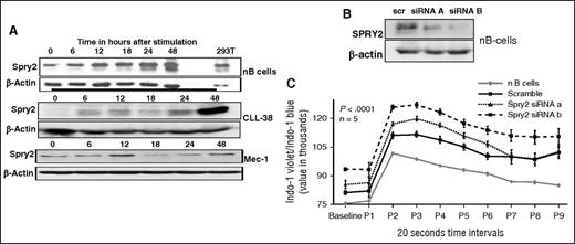 Figure 2. Effect of SPRY2 on BCR signaling. To study the role of SPRY2 in CLL and nB cells, we isolated CLL and nB cells from patients and healthy donors, respectively. (A) nB cells, primary human CLL cells, and Mec-1 CLL cells were stimulated by BCR crosslinking for 0, 6, 12, 18, 24, and 48 hours. Cells were washed and protein lysate was prepared. Protein level of SPRY2 was determined by western blotting. SPRY2 levels in nB cells (top), SPRY2 levels in primary CLL cells from patient (middle), and SPRY2 levels in Mec-1 CLL cells (bottom) are shown. (B) To test the efficacy of siRNAs against SPRY2, nB cells were transfected with siRNAa and siRNAb after 48 hours of transfection cells, and were washed and lysate was prepared. An equal amount of protein was loaded in each well, and scramble siRNA and β-actin was used as control. Displayed is scanned western blot showing decrease in SPRY2 levels after siRNA treatment. (C) nB cells were isolated from healthy donors and nucleofected with scramble, siRNA A, and siRNA B. After 48 hours, calcium influx assay was performed using Indo-1 dye dots representing 20-second time intervals. Displayed is mean graph of Indo-1 violet/Indo-1 blue ratio, nB-cell samples from different healthy donors (n = 5), and P < .0001.