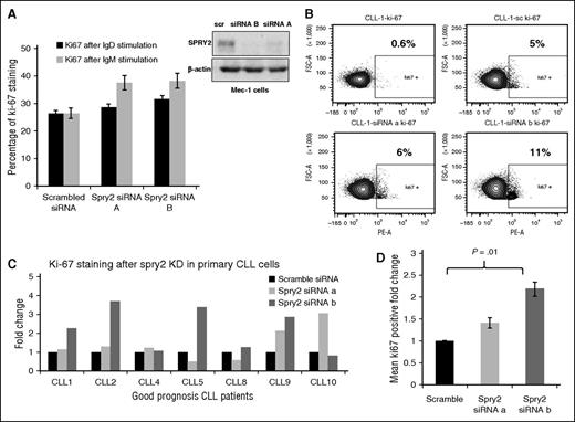 Figure 3. Knockdown of SPRY2 increases proliferation of CLL cells from good-prognosis patients. To determine the effect of SPRY2 knockdown on human CLL cells, we used Mec-1 cells and primary CLL cells from good-prognosis CLL patients. (A) Mean bar graph of 3 repeats showing Ki-67 staining of Mec-1 cells after SPRY2 knockdown with anti-IgM and anti-IgD antibody stimulation (left) and scanned western blot (right), showing decrease in SPRY2 protein levels after siRNAs treatment. (B) Dot plot of patient’s sample CLL-1 showing an increase in proliferation after SPRY2 knockdown using two different siRNA. (C) CLL cells were isolated from PB of different good-prognosis CLL patients (n = 7). CLL cells were nucleofected with scramble, siRNA A and siRNA B, and coculture on S-17 stromal layer. After 48 hours, CLL cells were stained with Ki-67 stain and proliferation was measured. Displayed bar graph is fold in the rate of proliferation of CLL cells. (D) Mean fold change of (C) showing significant (P = .01) increase in proliferation after SPRY2 knockdown with siRNA B.