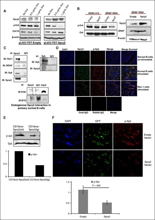 Figure 6. SPRY2 downregulate MAPK-ERK signaling by interacting with RAF-1, Syk, and BRAF. (A) Mec-1 cells were transfected with pLKO-TET-empty and pLKO-TET-Spry2. Cells were treated with DOX for 4 days to induce the expression of SPRY2. Displayed is a scanned western blot of CLL cells transfected with empty and spry2 cDNA to measure the protein levels of SPRY2 and p-Erk upon DOX treatment. β-actin and PAN (total) Erk1/2 were used as controls. (B) KRAS-V12 and BRAF-V600 mutants were co-transfected with empty and Spry2 vectors in Mec-1 cells. Scanned western blot showing the p-Erk and Erk levels in these cells (left). Scanned western blot of SPRY2 and BRAF protein levels in the same cells (right); β-actin was used as loading control. (C) Human nB cells were isolated from healthy donors and cells were stimulated by BCR crosslinking for 24 hours. Cells were lysed to prepare lysate for immunoprecipitation (IP) (described in supplemental Methods). Displayed is a scanned western blot of immunoprecipitation with SPRY2 and Syk showing pull-down of RAF-1, Syk, BRAF, and SPRY2. IgG, Pi3K, and BTK were used as negative controls. (D) nB cells and Mec-1 cells were stimulated as described in (C) and cyotospin were prepared using these cells. Cells were stained with SPRY2, p-Syk, and DAPI fluorescence antibody. Displayed are immunofluorescence images showing co-localization of SPRY2 and p-Syk in nB cells and Mec-1 CLL cells. Unstimulated cells, goat-IgG, and rabbit-IgG were used as control. (E) nB cells were isolated from spleen of CD19-cre;Spry2(wt) and CD19-cre;Spry2(tg) mice, and stimulated for 30 minutes with anti-IgM antibody. Displayed is scanned western blot of p-Syk and Syk, and densitometric measurements showing normalized decreased levels of p-Syk. (F) Mec-1 CLL cells were overexpressed with Spry2 cDNA and empty vector co-expressing GFP; cytospins were prepared of these cells. Slides were stained with p-Syk (red) antibody. Displayed are immunofluorescence images and densitometric measurements showing decreased levels of normalized p-Syk in SPRY2 co-expressing GFP-positive cells. DAPI, 4,6 diamidino-2-phenylindole; IB, immunoblotting.