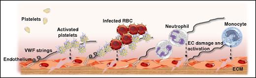 Figure 1. Putative mechanisms through which VWF secreted from ECs may influence the pathogenesis of P falciparum malaria. At an early stage following P falciparum infection, acute EC activation results in WP body exocytosis. Consequently, plasma VWF:Ag levels are significantly increased, and pathological UL-VWF multimers accumulate in the plasma. While tethered on the surface of activated ECs, UL-VWF can bind circulating platelets. These bound activated platelets further activate the underlying ECs (see dashed line). In addition, CD36 expressed on the platelet surface of these platelet-decorated UL-VWF strings can bind to PfEMP1, thereby facilitating the cytoadhesion and sequestration of IEs. This VWF-modulated IE cytoadhesion may be of particular importance in the cerebral microvasculature where there is no constitutive CD36 expression on ECs. Once again, IE cytoadhesion further stimulates EC activation and dysfunction. Finally, in addition to being important in modulating platelet and IE recruitment, VWF can also bind to neutrophils and monocytes, both of which can enhance EC damage resulting in enhanced EC permeability. ECM, experimental cerebral malaria; RBC, red blood cell.