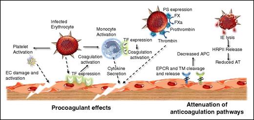 Figure 2. P falciparum infection causes coagulation activation through multiple different mechanisms. Procoagulant effects: P falciparum infection causes early EC activation and platelet activation. Furthermore, IEs induce TF expression on EC surfaces and on monocytes. This aberrant intravascular TF expression in combination with FVIIa results in initiation of the extrinsic coagulation pathway. In addition, P falciparum infection leads to expression of negatively charged PS on the red cell surface. This PS enables the assembly of the intrinsic tenase and prothrombinase complexes, thereby enhancing coagulation amplification. Activated clotting factor proteases (notably FXa and thrombin) generated through P falciparum–induced coagulation activation interact with specific EC surface including protease-activated receptor (PAR) 1 and thereby initiate downstream intracellular signaling, which ultimately results in enhanced EC activation, damage, and apoptosis. Attenuation of normal anticoagulant effects: In addition to the specific procoagulant effects described previously, P falciparum infection further promotes coagulation activation by downregulating normal endogenous anticoagulant pathways. EC surface expression of TM and the EPCR are both reduced, likely because of cytokine-enhanced shedding. Moreover, plasma levels of soluble TM and soluble EPCR (sEPCR) are both increased. Together, these effects combine to lead to a significant reduction in generation of anti-inflammatory and cytoprotective activated protein C (APC) on the EC surface. Finally, release of HRPII following spontaneous IE lysis significantly inhibits the anticoagulant effects of antithrombin (AT).